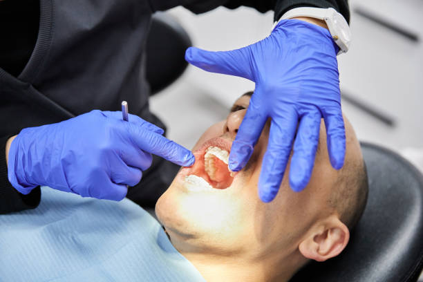 Best Emergency Dentist for Lost Fillings or Crowns in Woodbridge, VA
