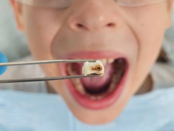 Best Emergency Dental Services for Seniors in Woodbridge, VA
